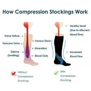 what do compression socks do