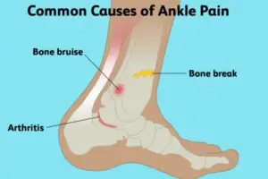 causes of ankle pain
