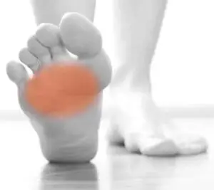 causes of metatarsalgia or ball of foot pain